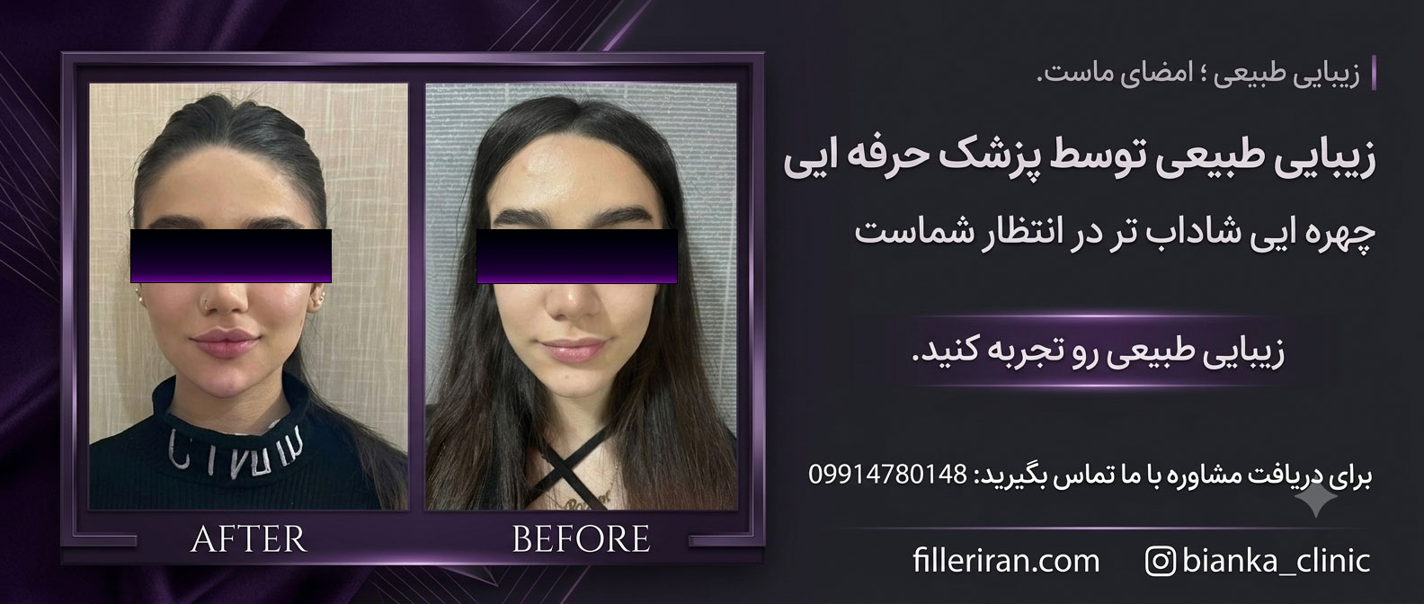 filler3