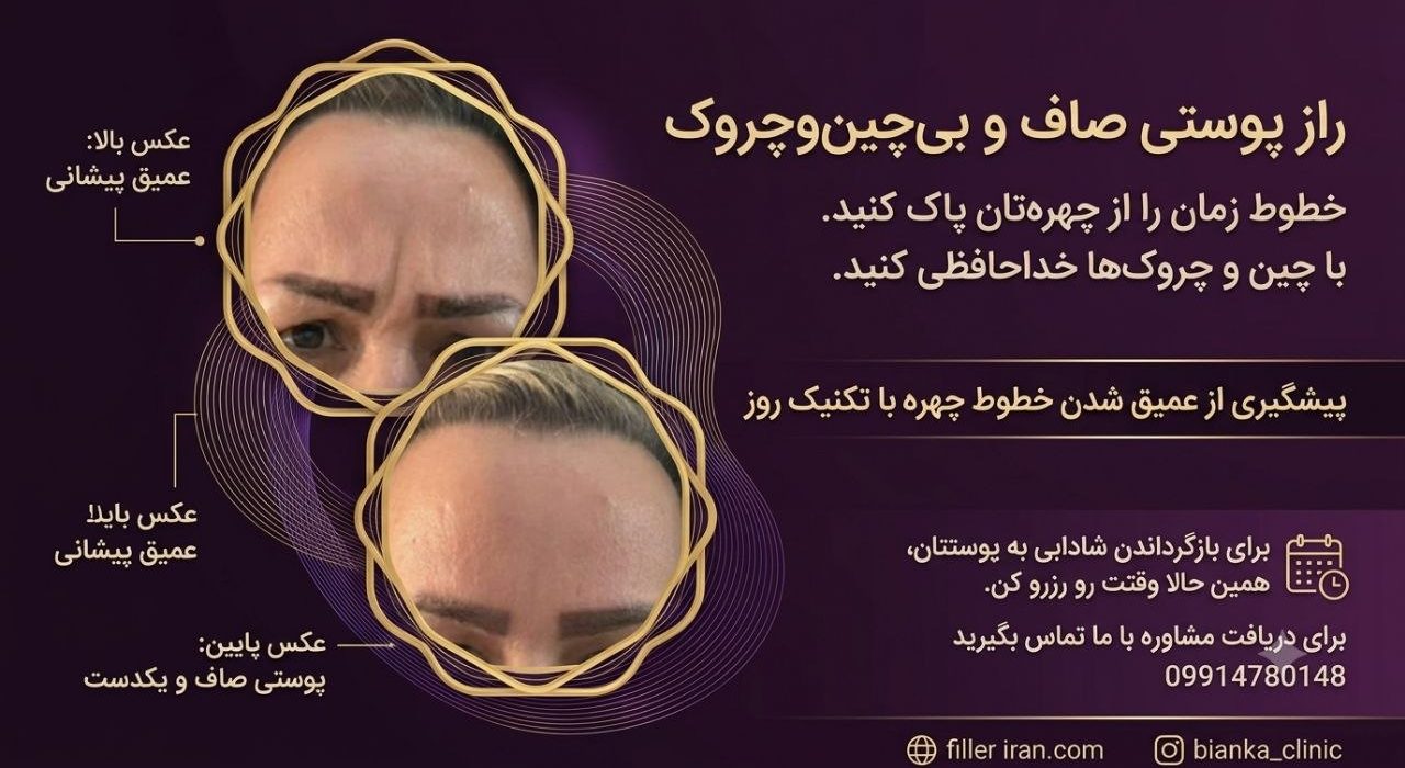 تزریق بوتاکس تهران تزریق بوتاکس تهران