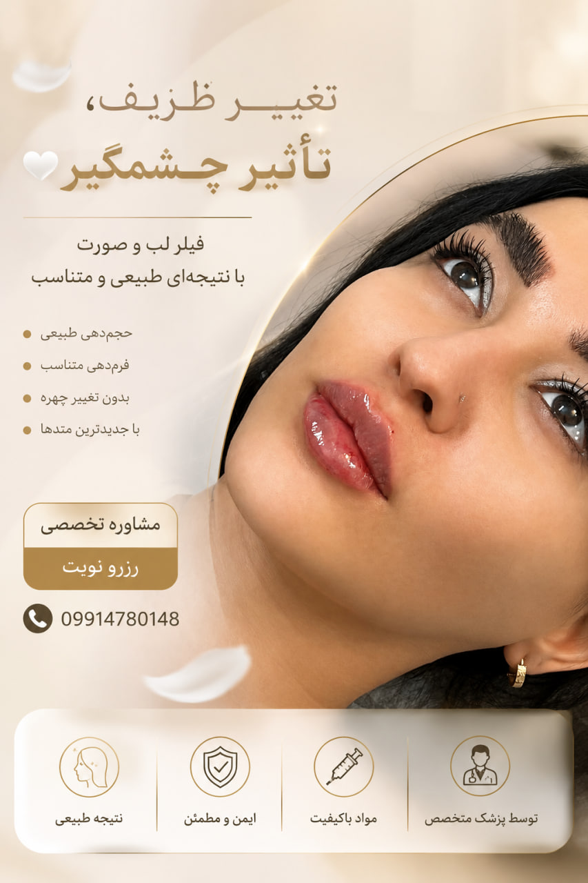 تزریق ژل لب خوب در تهران